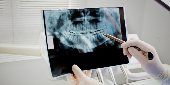 Dr. Robert Coe DDS looking at a patient's x rays