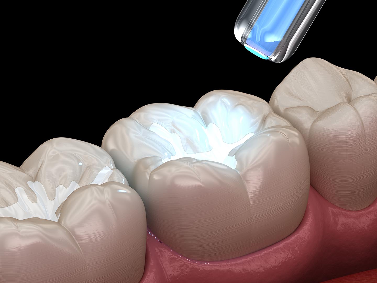 Dentist in Escondido, CA | Roshni Patel DDS