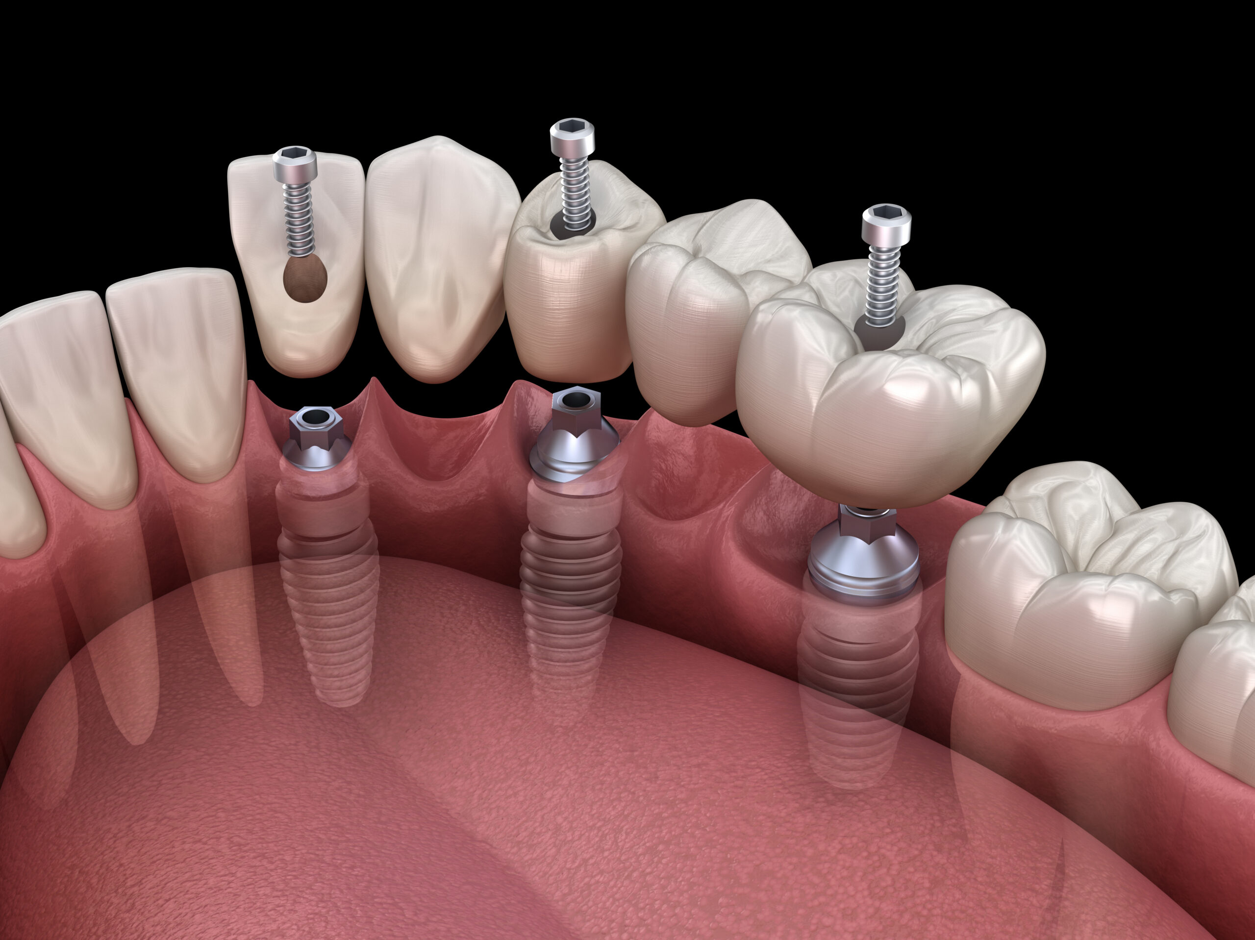Dentist in Escondido, CA | Roshni Patel DDS
